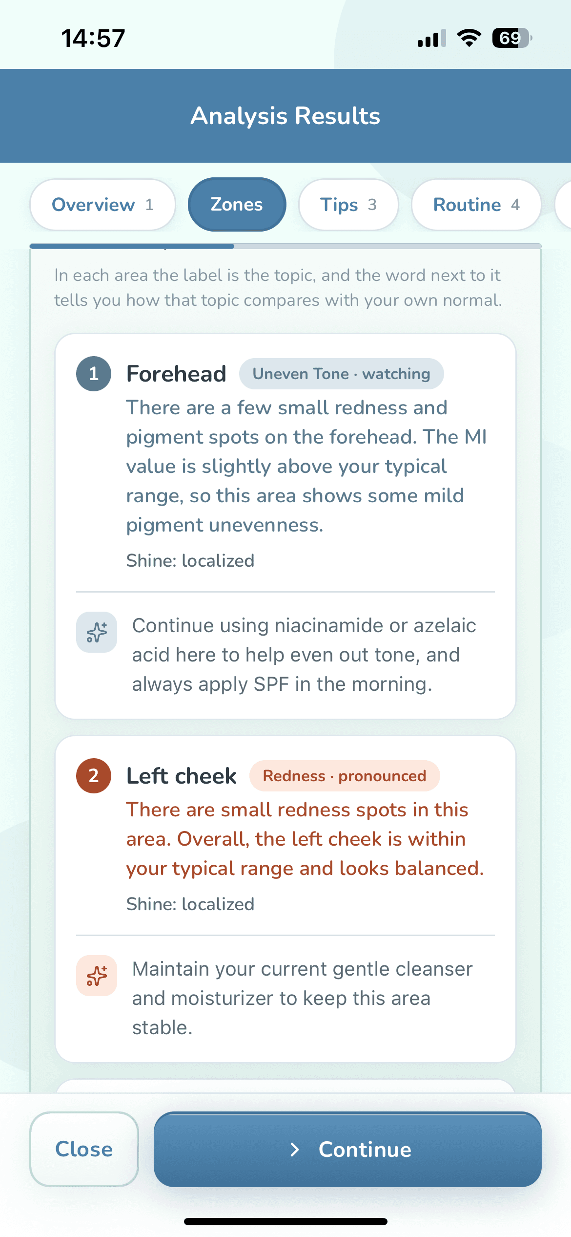 Analysis result, Zones step: cards for forehead, cheeks, nose and chin